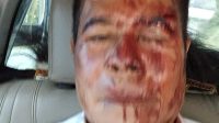 Warinussy Mendorong Polda Papua, Ungkap Pelaku Kekerasan Terhadap Pejabat Gubernur