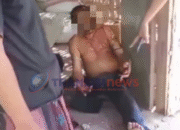 Driver Gojek di Sampang Kena Begal Penumpang, Tubuh Dibakar dengan Bensin