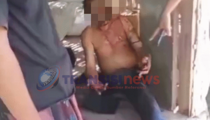 Driver Gojek di Sampang Kena Begal Penumpang, Tubuh Dibakar dengan Bensin