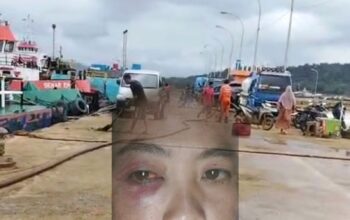 Lambat Pelayanan Terkait Penganiayaan, Herlina Desak Polres Konawe Utara Segera Proses Laporannya.